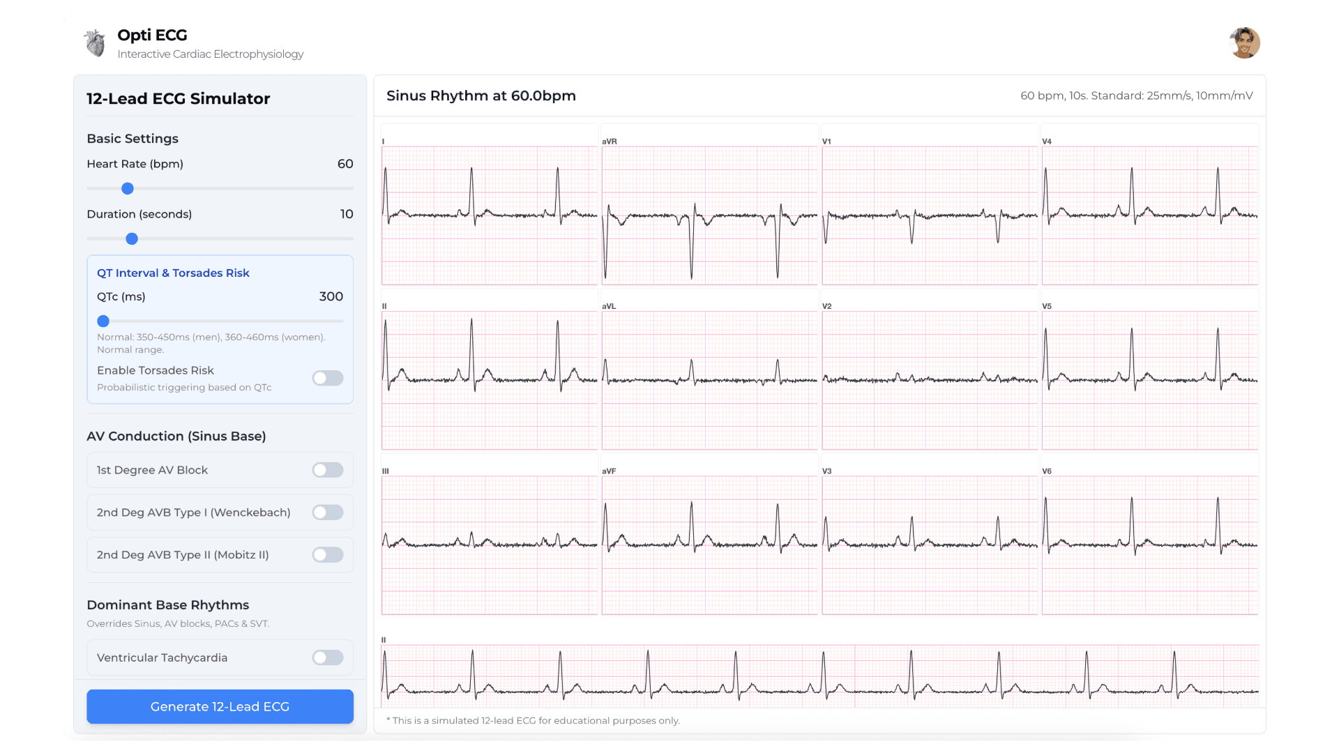 ECG Simulator visualization